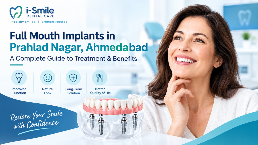 Full Mouth Implants in Prahlad Nagar, Ahmedabad: A Complete Guide to Treatment & Benefits